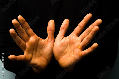 Photo: Tied hands Tied hands
