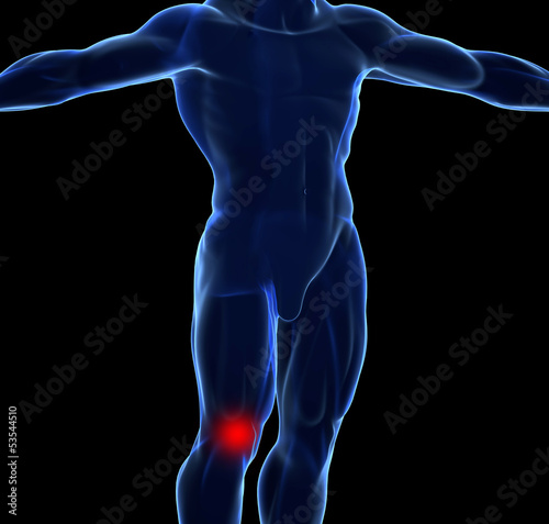 Illustration: Knee Pain concept Knee Pain concept