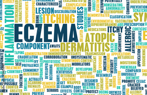 Illustration: Eczema Eczema