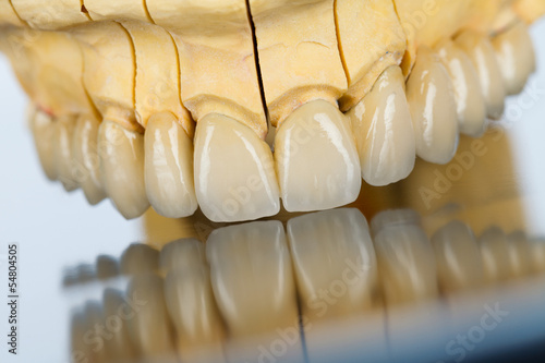 Photo: Ceramic teeth - dental bridge Ceramic teeth - dental bridge