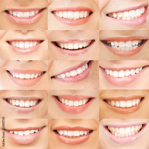 Photo: examples of female smiles examples of female smiles