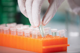 Photo: Deutschland, Bayern, München, Wissenschaftler mit Reagenzgläsern medizinischen Forschung zu tun Deutschland, Bayern, München, Wissenschaftler mit Reagenzgläsern medizinischen Forschung zu tun