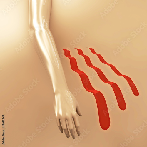 Illustration: Parkinson - 3D Render Parkinson - 3D Render