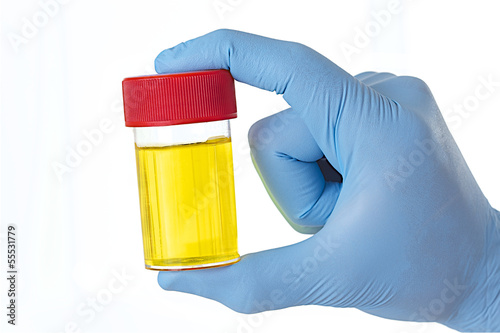 Photo: Échantilon d'urine - Analyse médicale Échantilon d'urine - Analyse médicale