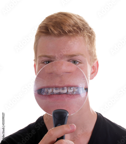 Photo: Zahnspange unter der Lupe Zahnspange unter der Lupe