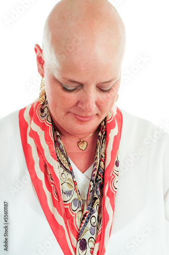 Photo: Cancer Survivor - Hair Loss Cancer Survivor - Hair Loss
