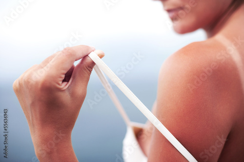 Photo: Severely burned skin, dark tanned body Severely burned skin, dark tanned body