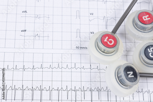 Photo: Cardiogram pulse trace and a electrodes Cardiogram pulse trace and a electrodes