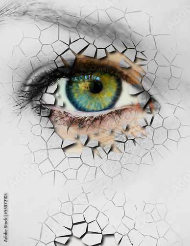Photo: Cracked skin Cracked skin