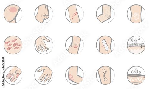 Vector: Skin diseases Skin diseases