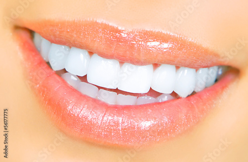 Photo: woman teeth woman teeth