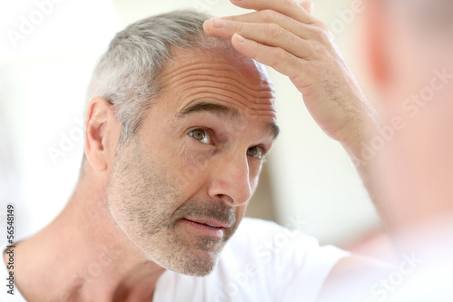 Photo: Senior man and hair loss issue Senior man and hair loss issue