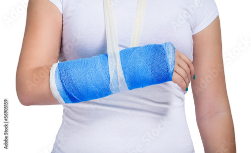 Photo: Patient with a cast on arm Patient with a cast on arm