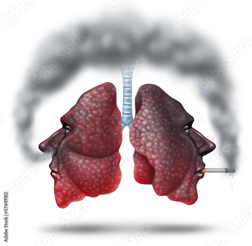 Illustration: Second Hand Smoke Second Hand Smoke