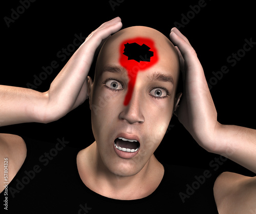 Illustration: Head Wound Head Wound