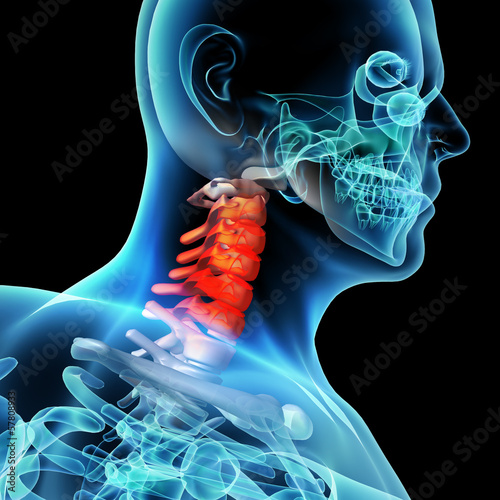 Illustration: 3d rendered illustration - pain neck 3d rendered illustration - pain neck