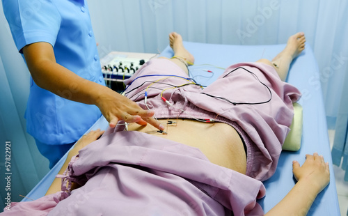 Photo: Electrical stimulating acupuncture treatment by a nurse for an a Electrical stimulating acupuncture treatment by a nurse for an a