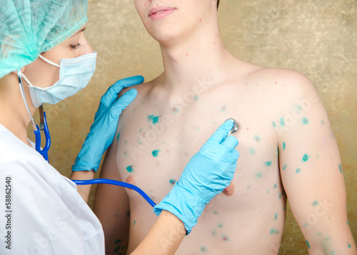 Photo: Chickenpox. Skin rash. Viral disease. Chickenpox. Skin rash. Viral disease.