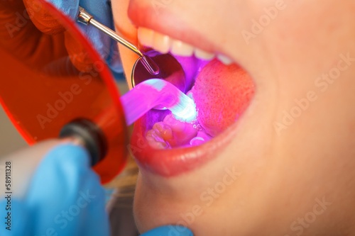 Photo: Dental obturation Dental obturation