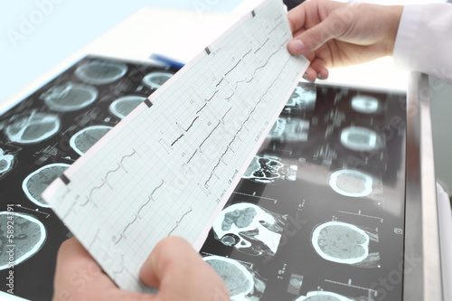 Photo: Study of ECG and tomography Study of ECG and tomography
