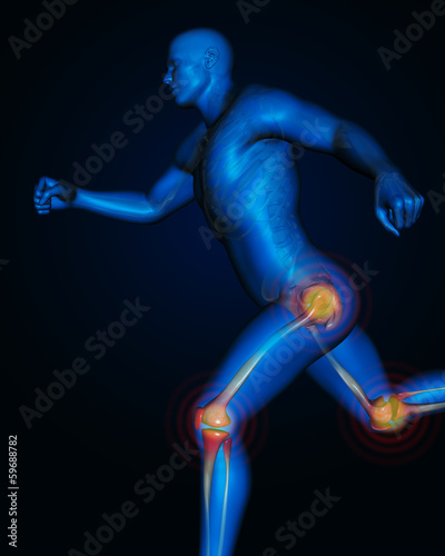 Illustration: Joints pain Joints pain