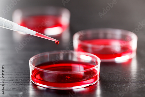 Photo: petri dishes and micropipette, pathogens test petri dishes and micropipette, pathogens test