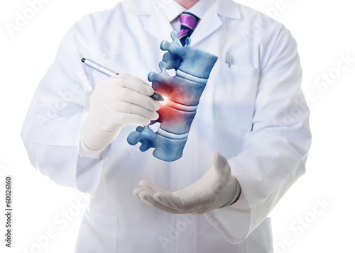 Photo: Vertebrae illness Vertebrae illness
