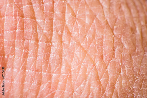 Photo: Texture of human skin Texture of human skin