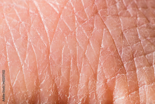 Photo: Texture of human skin Texture of human skin