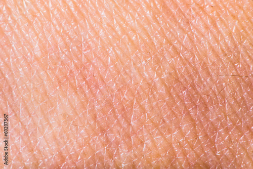 Photo: Texture of human skin Texture of human skin