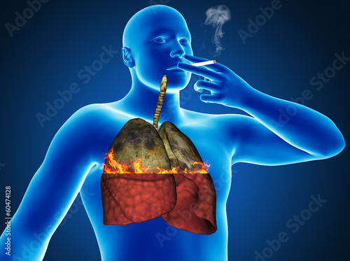Illustration: Heavy smoker Heavy smoker