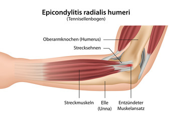 Vector: Transvaginale Ultraschalluntersuchung der Eierstöcke