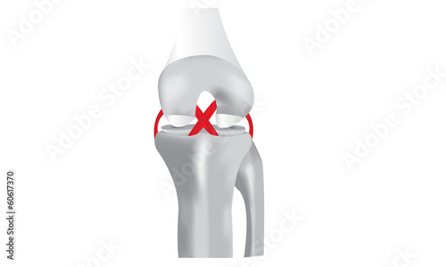 Vector: The Knee Joint The Knee Joint