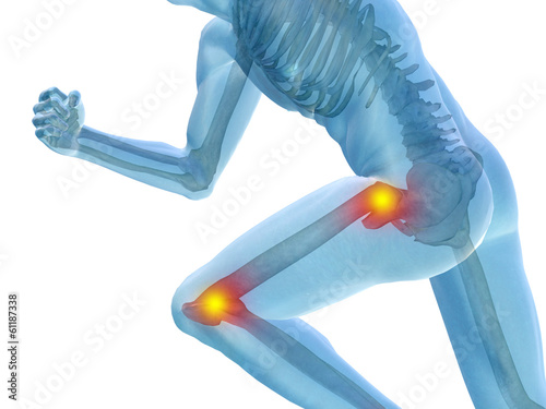 Illustration: Conceptual human pain anatomy Conceptual human pain anatomy