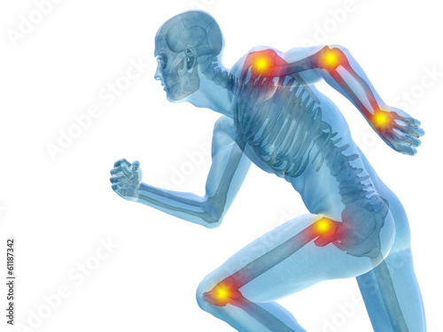 Illustration: Conceptual human pain anatomy Conceptual human pain anatomy