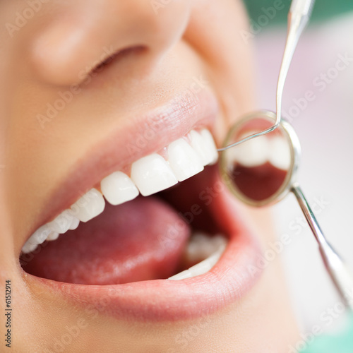 Photo: Close up of Dentist examination Close up of Dentist examination