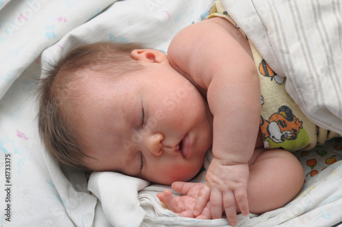 Photo: Newborn baby with allergic sleeps Newborn baby with allergic sleeps