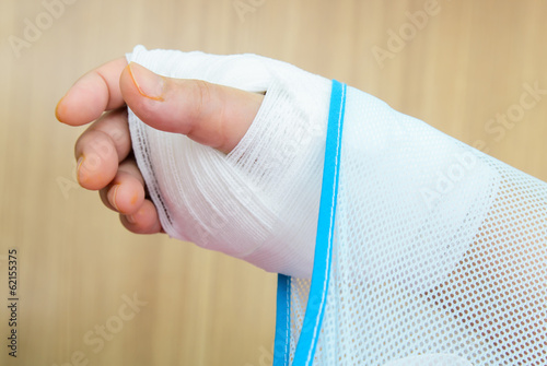 Photo: Hand injury Hand injury
