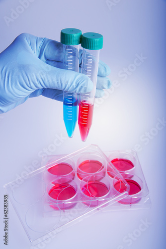 Photo: Cell culture for the fluorescent analysis. Plastic plate Cell culture for the fluorescent analysis. Plastic plate