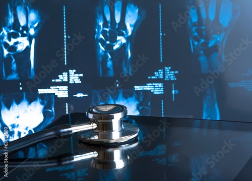 Photo: stethoscope on digital tablet pc in laboratory on x-ray images stethoscope on digital tablet pc in laboratory on x-ray images