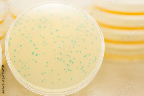 Photo: Blue bacteriophage plaques Blue bacteriophage plaques
