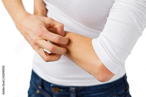 Photo: Eczema Eczema