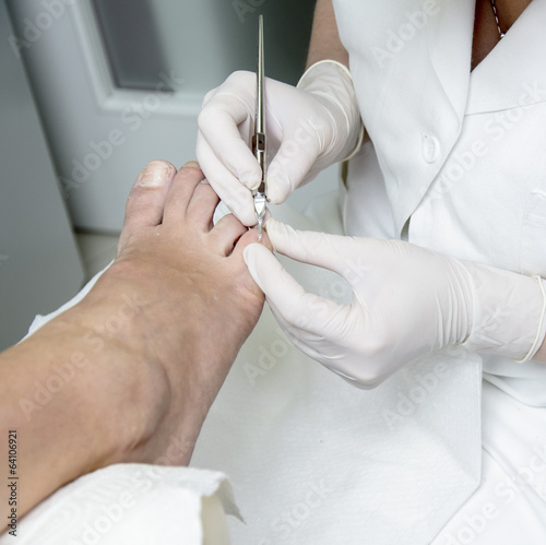 Photo: Pedicure treatment Pedicure treatment