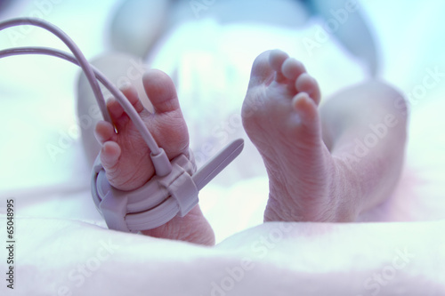 Photo: Feet of new born baby under ultraviolet lamp in the incubator Feet of new born baby under ultraviolet lamp in the incubator