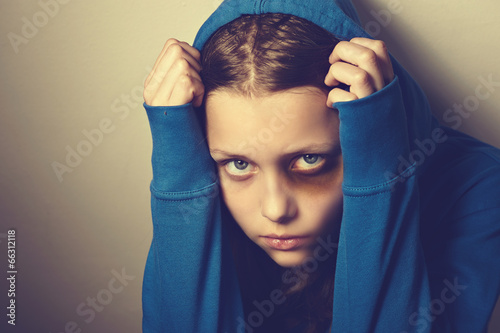 Photo: Afraided teen girl Afraided teen girl