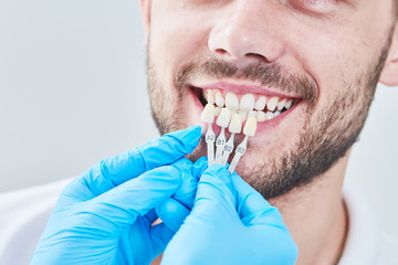 dentistry. matching colour of the tooth enamel with whitening chart