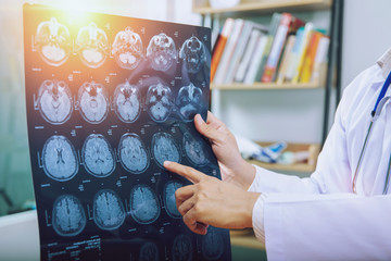 doctor give advice to patient about MRI (Xray) brain Scans