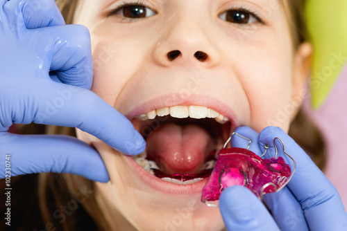 Zdjęcia Dental braces for cute little girl