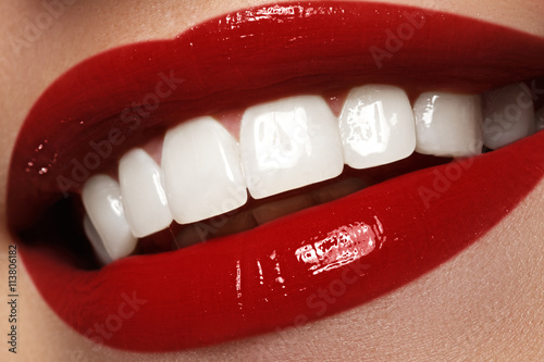Zdjęcia Perfect smile after bleaching. Dental care and whitening teeth