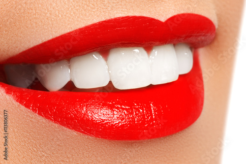 Zdjęcia Perfect smile after bleaching